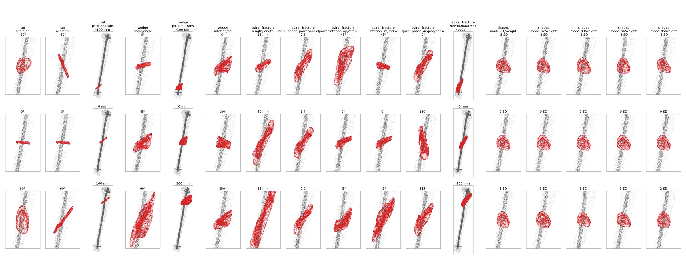 Callus (red) on the nailed tibia for each parameter series at its minimum, zero and maximum value